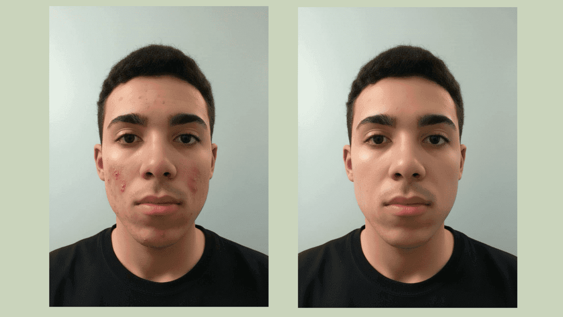 Nano Banana Photo Edit Feature